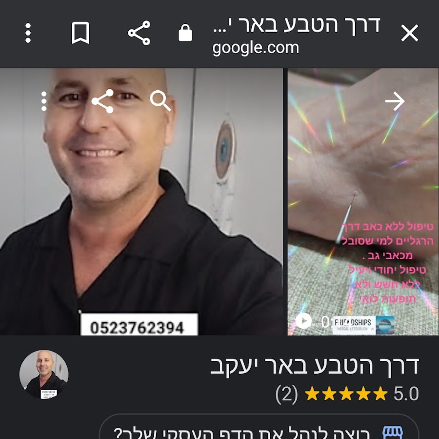 דיקור סיני בבאר יעקב